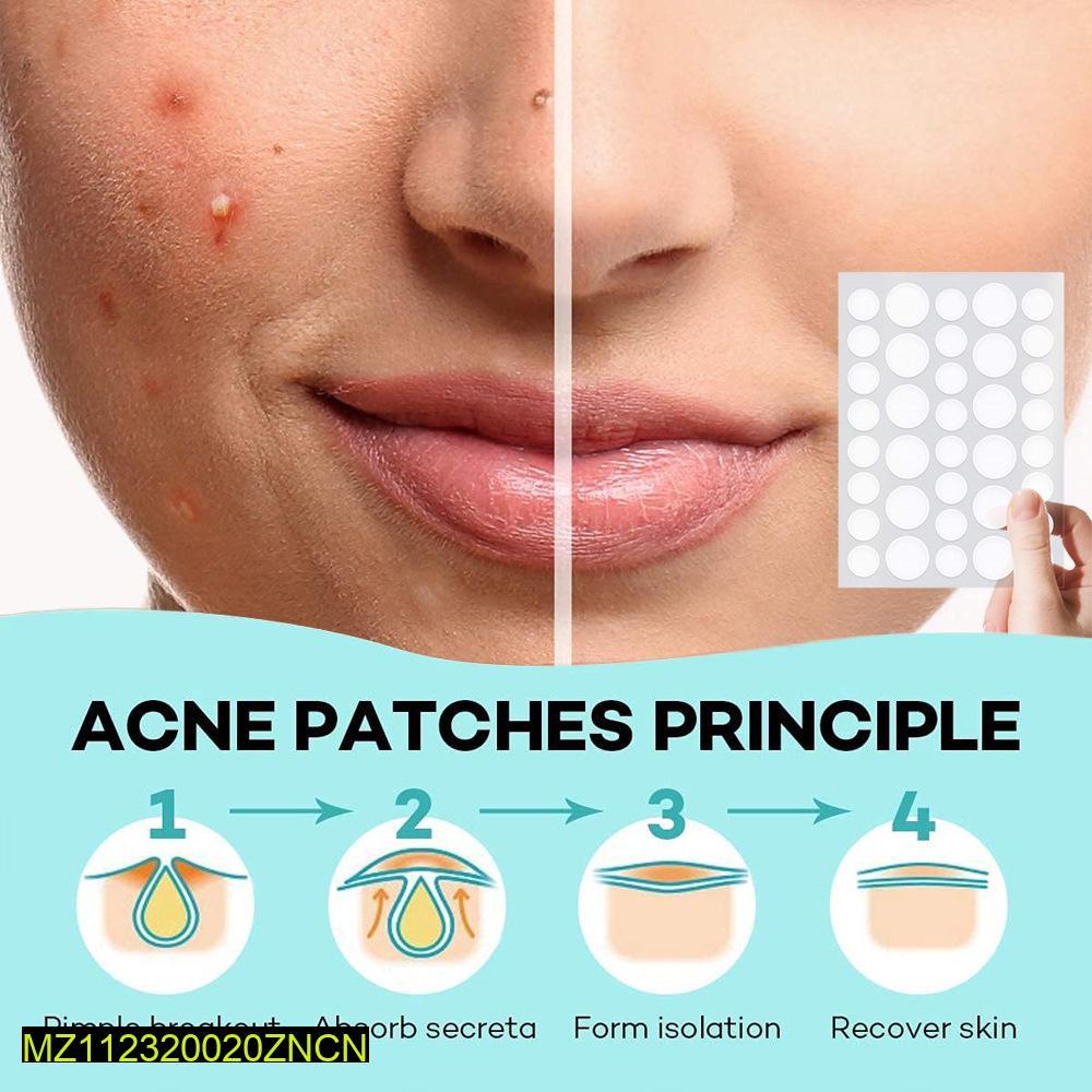 36 Pimple Patch Clearer Skin
