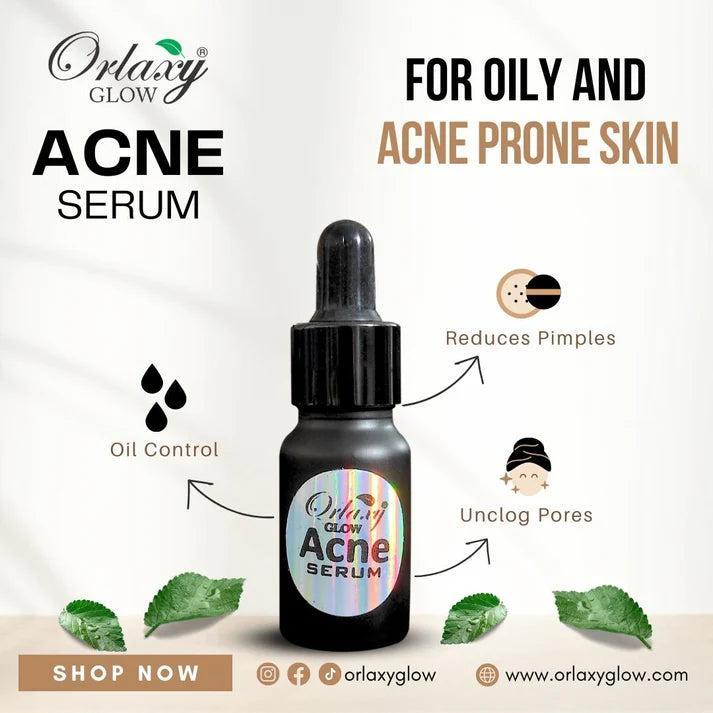Moon Touch-Acne Serum - For Oily & Acne Prone Skin By Orlaxy Glow