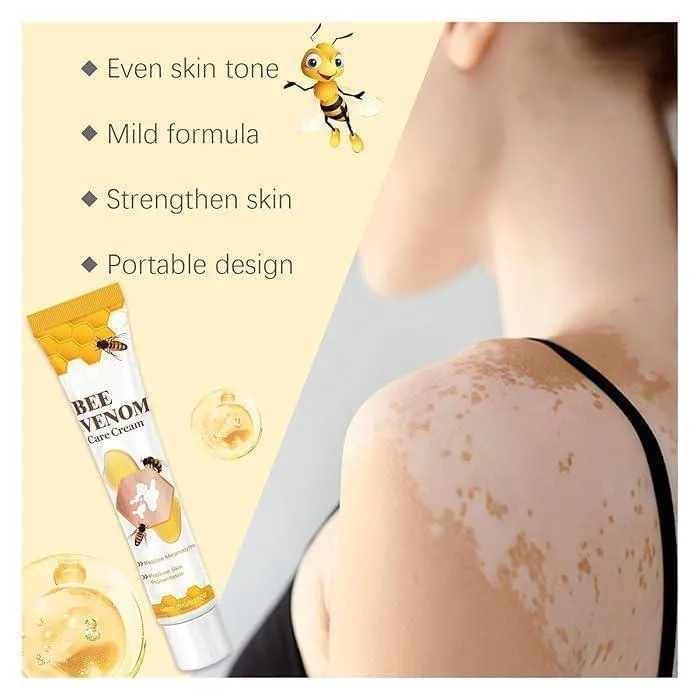 Bee Venom Vitigo Cream 
