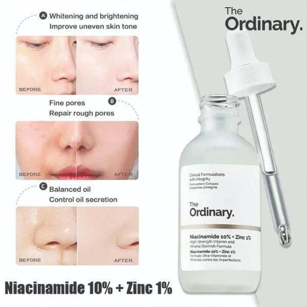 The Ordinary Niacinamide + Zinc Serum 30ml