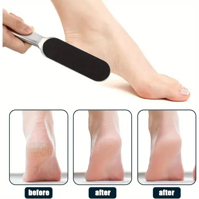 Dead Skin Removal Foot Filer
