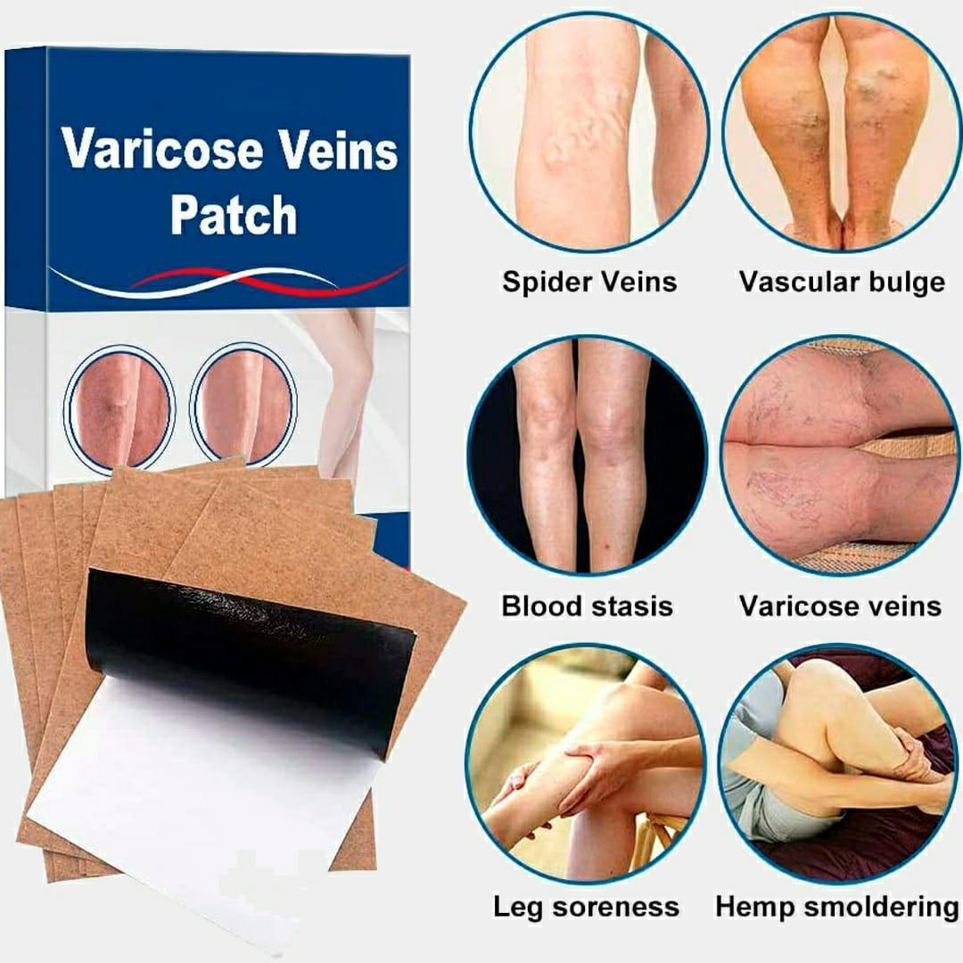 Clinically-Proven Varicose Veins Patch - 2 Pcs for Enhanced Wellness and Self-Care