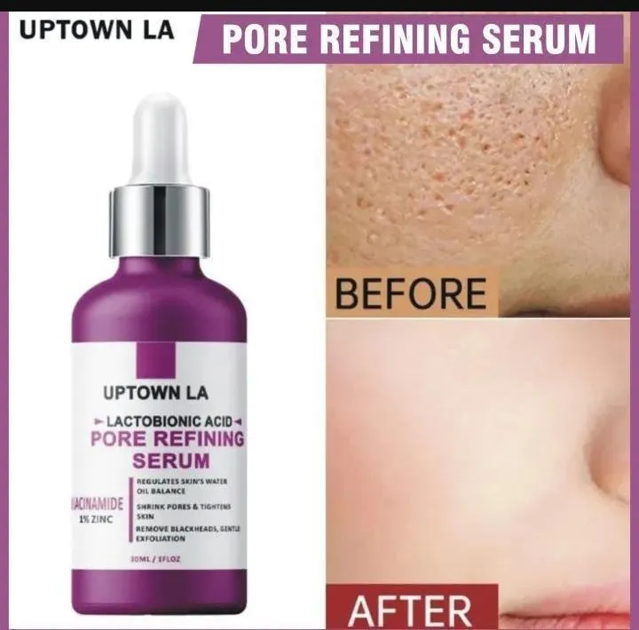 Uptown La Prevent Dryness And Dehydration Face Serum