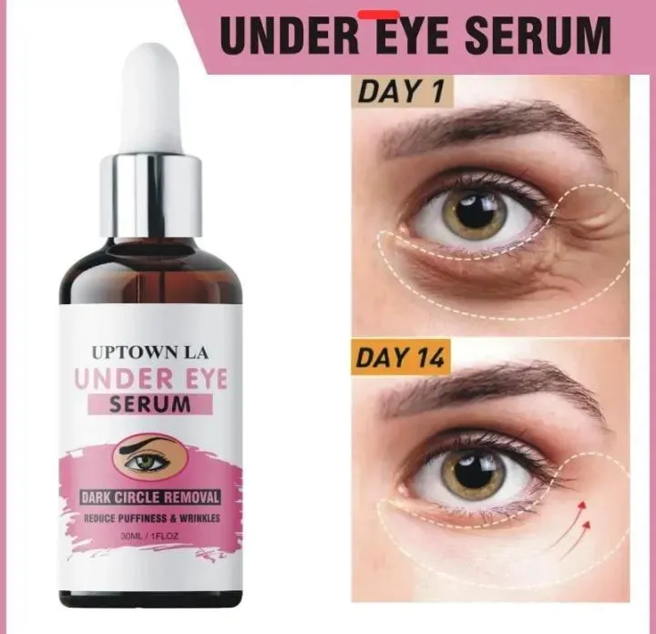 Uptown La Dark Spots Removal Eye Serum