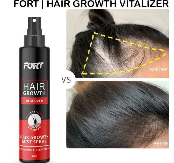 Anti-Dandruff Hair Building Fiber