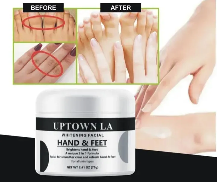 Uptown Hand And Foot Whitening Cream