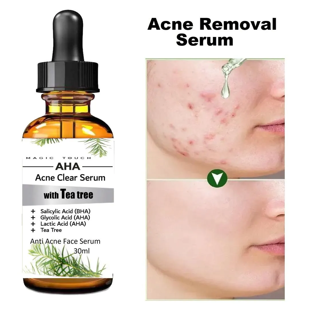 Anti-Acne Salicylic Acid Serum