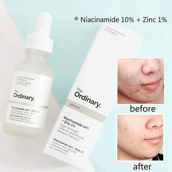 Niacinamide Skin Brightening Serum, 30 Ml