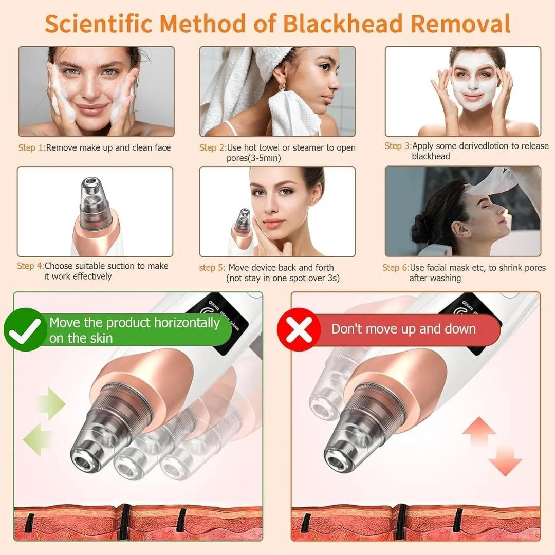 5-in-1 Electric Blackhead Remover USB Rechargeable