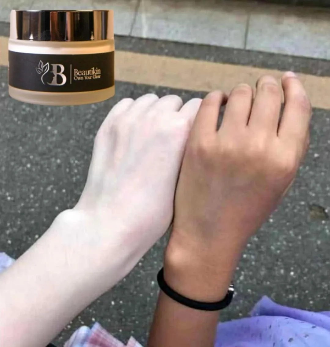 Whitening Cream - 1 Pcs for Radiant Skin | Whitening And Brightening