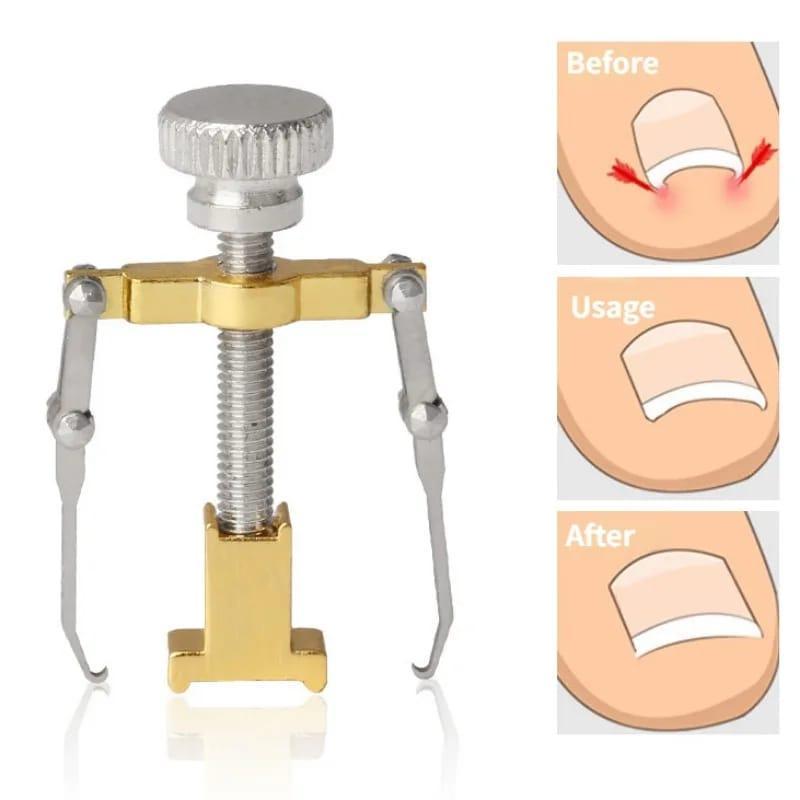 Ingrown Nail Correction Tool Golden Metal Travel Size