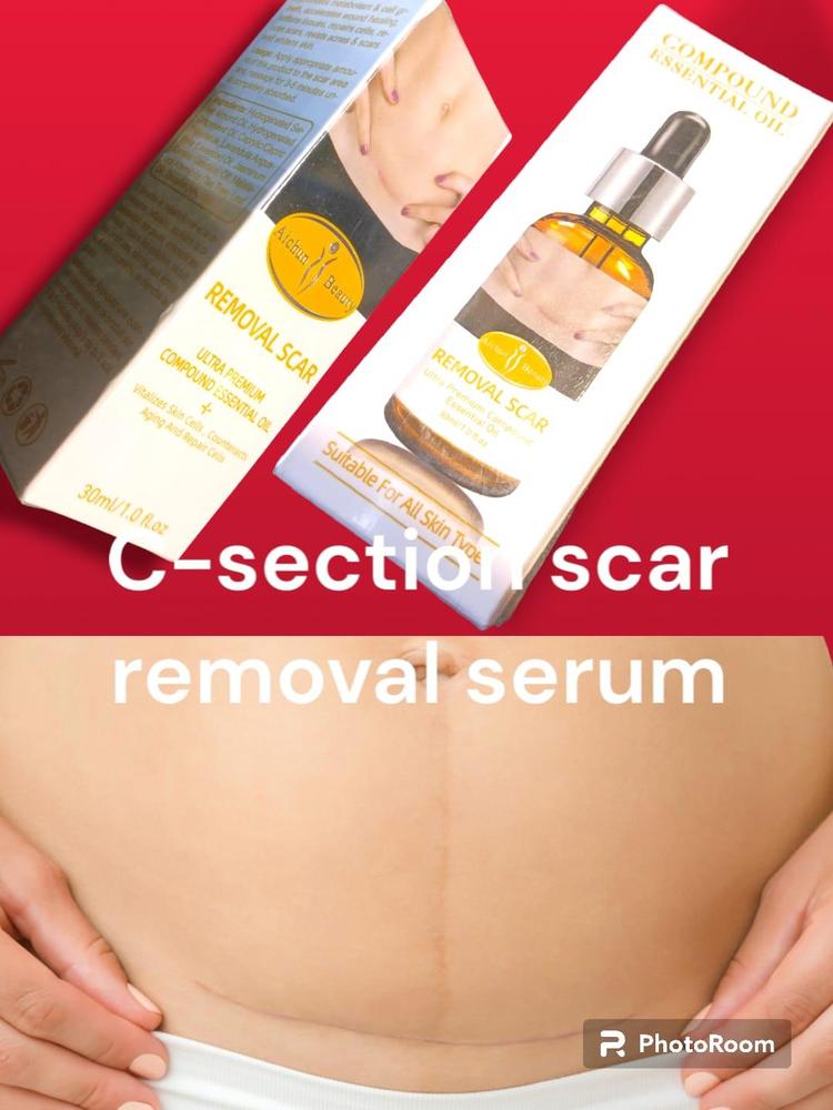 Acne Scar Removal Rejuvenation Serum, 30 Ml