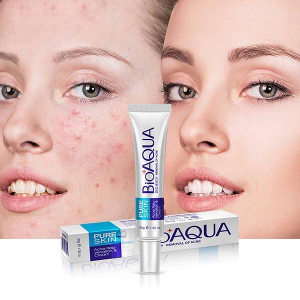Acne Scar Removal Rejuvenation Cream 30g