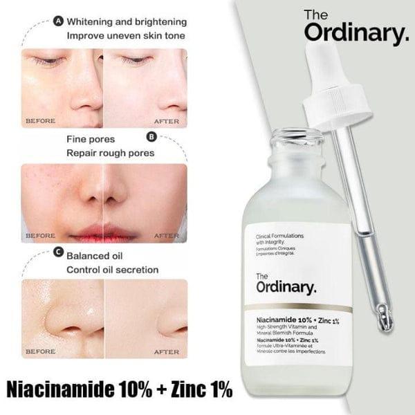 Niacinamide 20% + Zinc 1% - 30ml