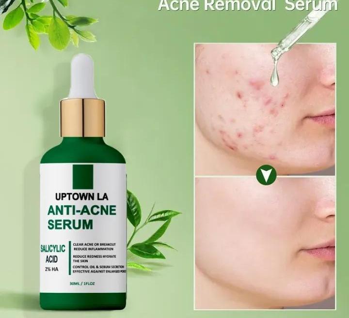 Anti-Acne Face Serum