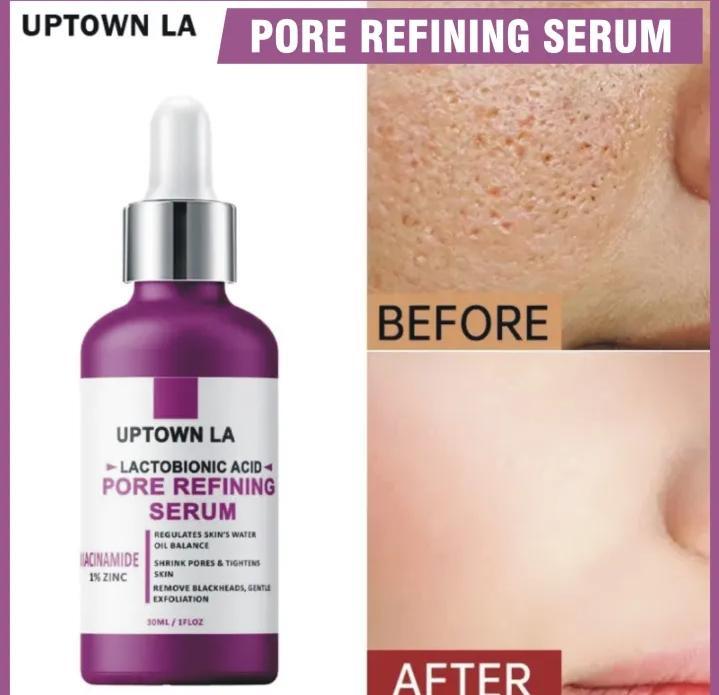 Anti-Acne Face Serum