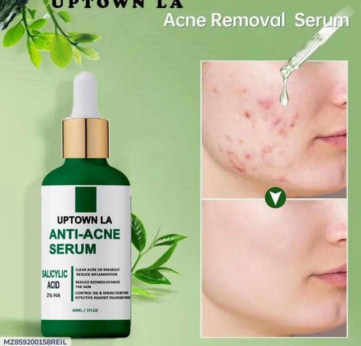 Uptown La Anti-Acne Face Serum