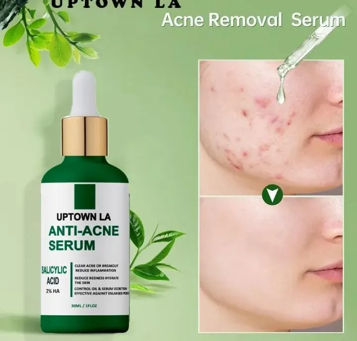 Uptown La Anti-Acne Face Serum