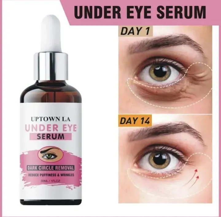 Uptown La Dark Spots Removal Under Eye Serum