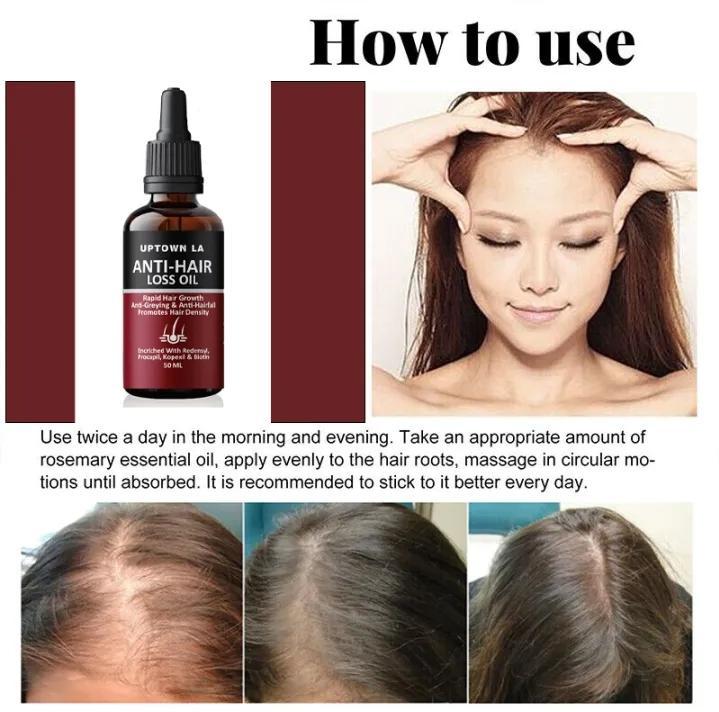 Anti-Hair Loss Hair Serum