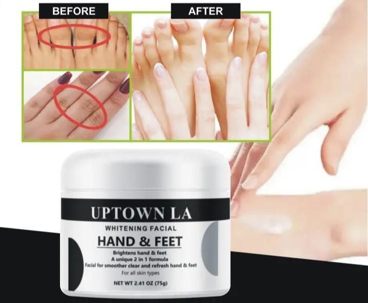 Whitening Whitening Cream