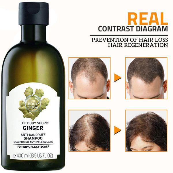 Anti-Dandruff Ginger Hair Shampoo, 400 Ml