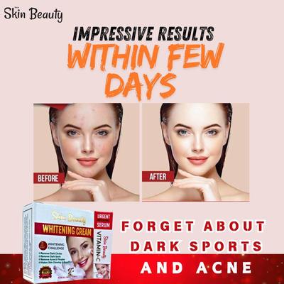 Exfoliator Whitening Cream