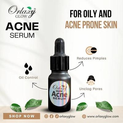 Moon Touch-Acne Serum - For Oily & Acne Prone Skin By Orlaxy Glow