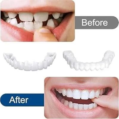 Snap On Fake Teeth Set thumbnail 2