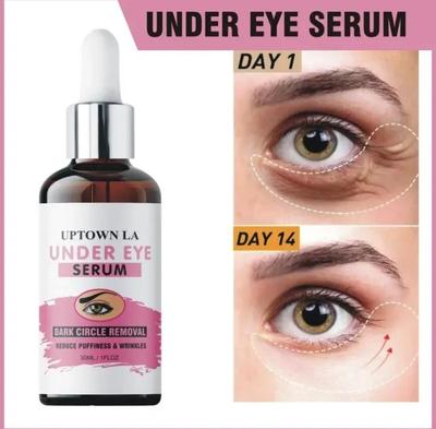 Removes Acne Marks & Dark Spots Eye Serum