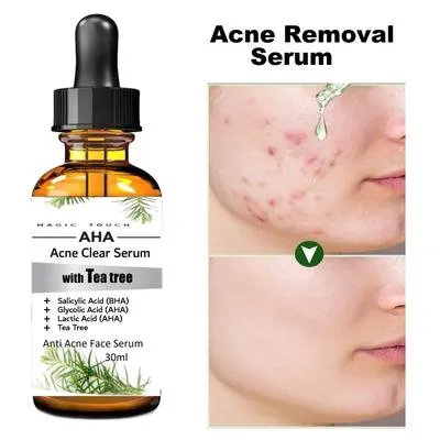 Anti-Acne Salicylic Acid Serum