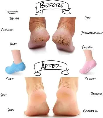 Pain Relief Socks